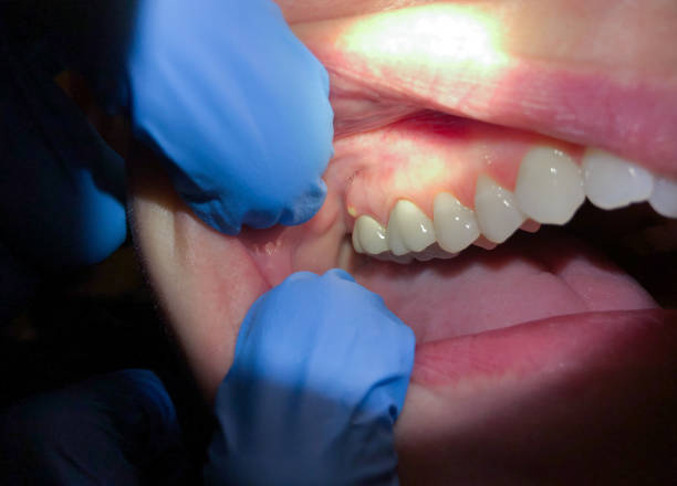 Best Pediatric Emergency Dentist in Spout Springs, NC